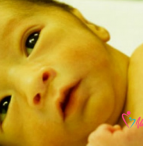 Ittero neonatale: che cos’è, cause e cura